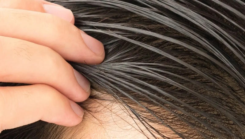 علت چرب شدن مو و راهکارهای رفع چربی مو